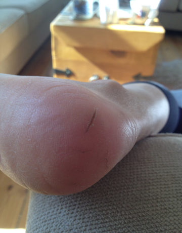 hael-2-efter
